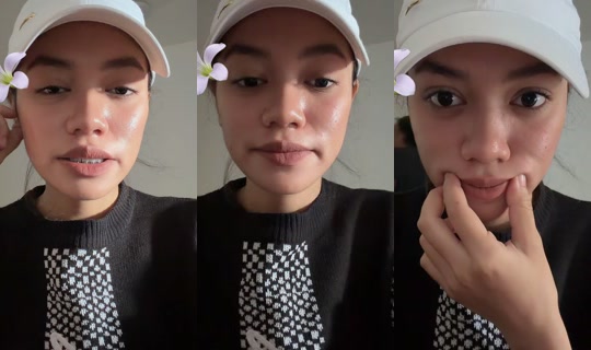 _cherms의 방송 - 2026년 8월 10일 AM 7:42