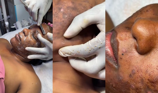 classicskintherapist Recorded on Jul 15, 2026, 11:29 AM