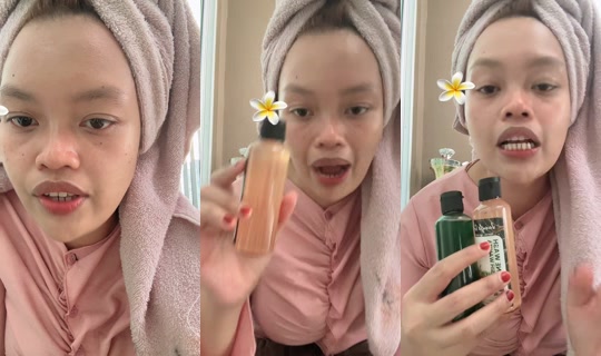 deruin.ly's Stream - Jul 30, 2026, 10:32 AM