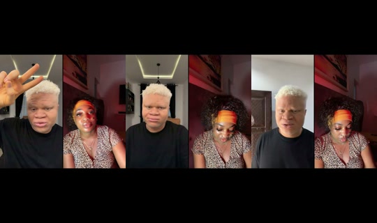 freshalbino_'s Stream - Jul 26, 2026, 6:28 AM