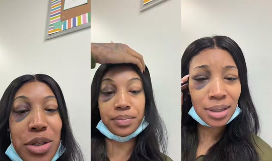 xoxomali_'s Stream - Jul 23, 2026, 8:03 PM